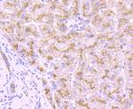 Cathepsin D Polyclonal Antibody