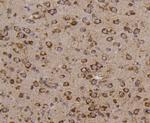 LYRIC Antibody in Immunohistochemistry (Paraffin) (IHC (P))
