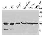 gamma Tubulin Polyclonal Antibody