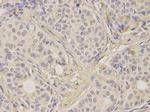 FGFR2 Polyclonal Antibody