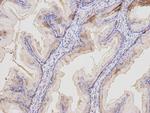 MAL Polyclonal Antibody