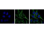 SQSTM1 Polyclonal Antibody