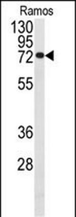 Cdc25B Polyclonal Antibody