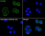 PLCB2 Antibody in Immunocytochemistry (ICC/IF)