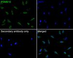 PSMB10 Polyclonal Antibody