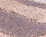 PLCB3 Antibody in Immunohistochemistry (Paraffin) (IHC (P))