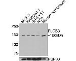 PLCB3 Antibody in Western Blot (WB)