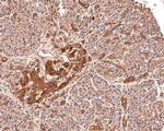 PPP2R1B Antibody in Immunohistochemistry (Paraffin) (IHC (P))