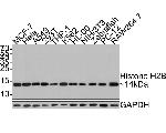 Histone H2B Antibody in Western Blot (WB)