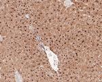 PSME4 Antibody in Immunohistochemistry (Paraffin) (IHC (P))