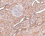 RPS27A Antibody in Immunohistochemistry (Paraffin) (IHC (P))