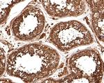 TUBA3C Antibody in Immunohistochemistry (Paraffin) (IHC (P))