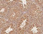 TUBA3C Antibody in Immunohistochemistry (Paraffin) (IHC (P))