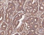 USP8 Polyclonal Antibody