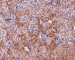 USP8 Antibody in Immunohistochemistry (Paraffin) (IHC (P))