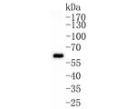 GRB7 Polyclonal Antibody