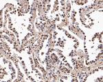 BRG1 Polyclonal Antibody