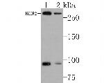 NCoR2 Polyclonal Antibody