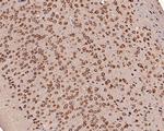 EEF1G Antibody in Immunohistochemistry (Paraffin) (IHC (P))