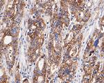 Claudin 18 Polyclonal Antibody