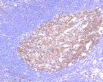 RANBP1 Antibody in Immunohistochemistry (Paraffin) (IHC (P))