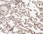 RhoGDI Antibody in Immunohistochemistry (Paraffin) (IHC (P))