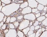RhoGDI Antibody in Immunohistochemistry (Paraffin) (IHC (P))