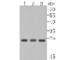 RhoGDI Antibody in Western Blot (WB)