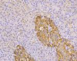 TMPRSS2 Polyclonal Antibody
