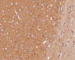 Dynamin 3 Polyclonal Antibody