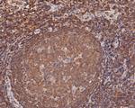 MST1 (STK4) Polyclonal Antibody