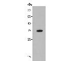MTHFD2 Polyclonal Antibody
