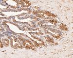 AKR1B1 Antibody in Immunohistochemistry (Paraffin) (IHC (P))