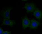 CD8 alpha Antibody in Immunocytochemistry (ICC/IF)