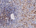 CD8 alpha Antibody in Immunohistochemistry (Paraffin) (IHC (P))