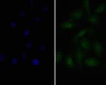 PAX8 Polyclonal Antibody