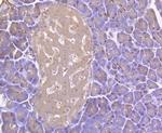 RIP3 Antibody in Immunohistochemistry (Paraffin) (IHC (P))