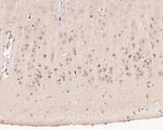 Pannexin 2 Polyclonal Antibody