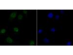 delta Catenin Polyclonal Antibody