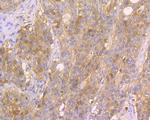 p16INK4a Antibody in Immunohistochemistry (Paraffin) (IHC (P))