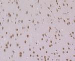 Histone Macro-H2A.1 Antibody in Immunohistochemistry (Paraffin) (IHC (P))
