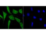BUBR1 Polyclonal Antibody