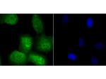 Securin Polyclonal Antibody