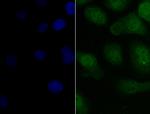 PAX8 Polyclonal Antibody