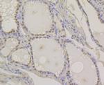 PAX8 Antibody in Immunohistochemistry (Paraffin) (IHC (P))