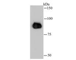 beta Catenin Polyclonal Antibody
