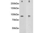 DCC Polyclonal Antibody