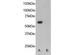 AIRE Polyclonal Antibody