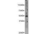 CELSR2 Antibody in Western Blot (WB)