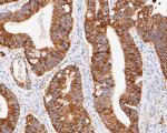 FAT1 Polyclonal Antibody